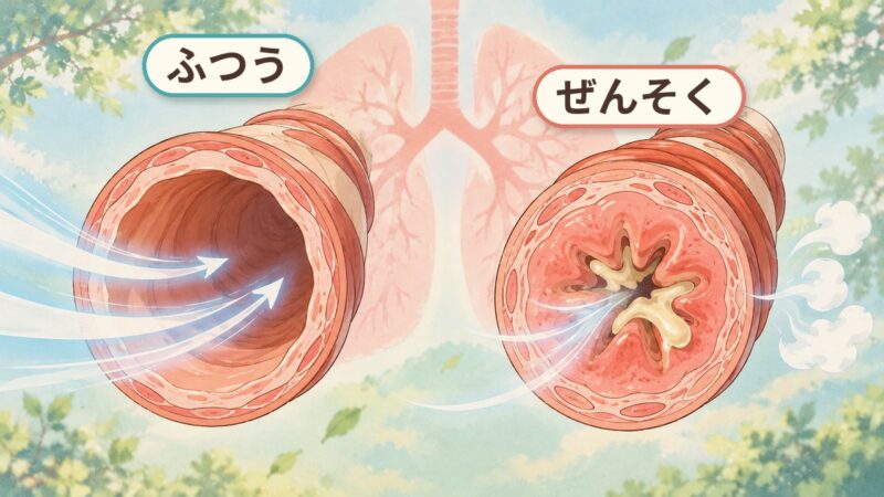 ふつうの気道とぜんそくの気道を並べたイラスト。ふつうの気道は内側が広く空気がよく通り、ぜんそくの気道は壁がむくんで厚くなり、まわりの筋肉が縮み、痰がたまって通り道が細くなっている